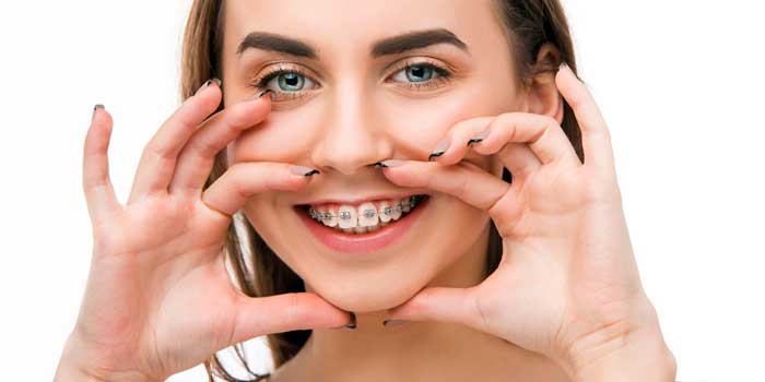 Braces Treatment in Jaipur